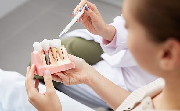 Zubní Implantologie